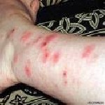 Уборка объявление но. 1037611: Мытищи клопы уничтожить с одного раза гарантия 89851532621