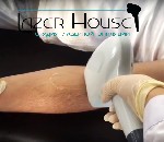 Салоны красоты объявление но. 1161032: Безболезненная эпиляция диодным лазером.