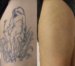 Салоны красоты объявление но. 1375807: Перманентный макияж, татуаж. Лазерное удаление тату