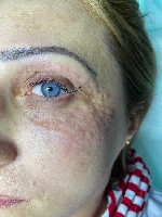 Косметика, парфюмерия объявление но. 1806890: Косметолог -эстетист