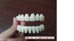 Виниры Snap on Smile мгновенно преображают любые проблемные зубы.  С ними всего за несколько секунд можно получить настоящую голливудскую улыбку.  

Элайнеры-виниры — это уникальная разработка,  воб ...